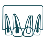 Clínica Abella Ribas - Cirugía Apicural