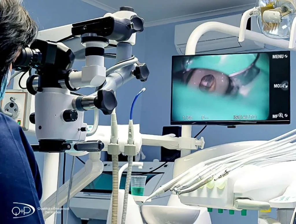 Clínica Abella Ribas - Tratamientos - Endodoncia Microscópica