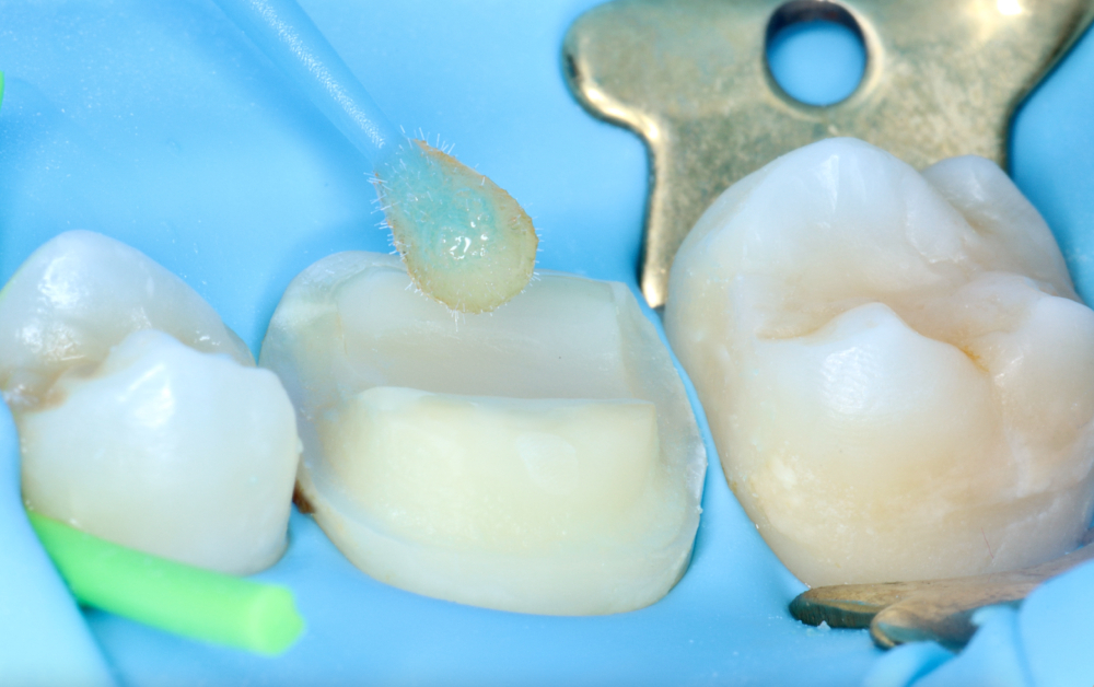 Clinica Abella Ribas - Tratamientos - Odontología General