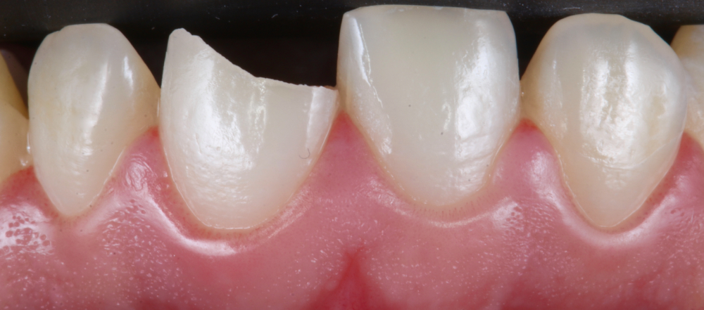 Clinica Abella Ribas - Tratamientos - Traumatismos