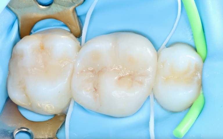 Clinica Abella Ribas - Tratamientos - Odontología General