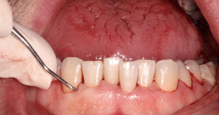 Clinica Abella Ribas - Tratamientos - Higiene Personalizada