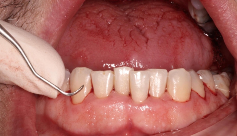 Clinica Abella Ribas - Tratamientos - Higiene Personalizada